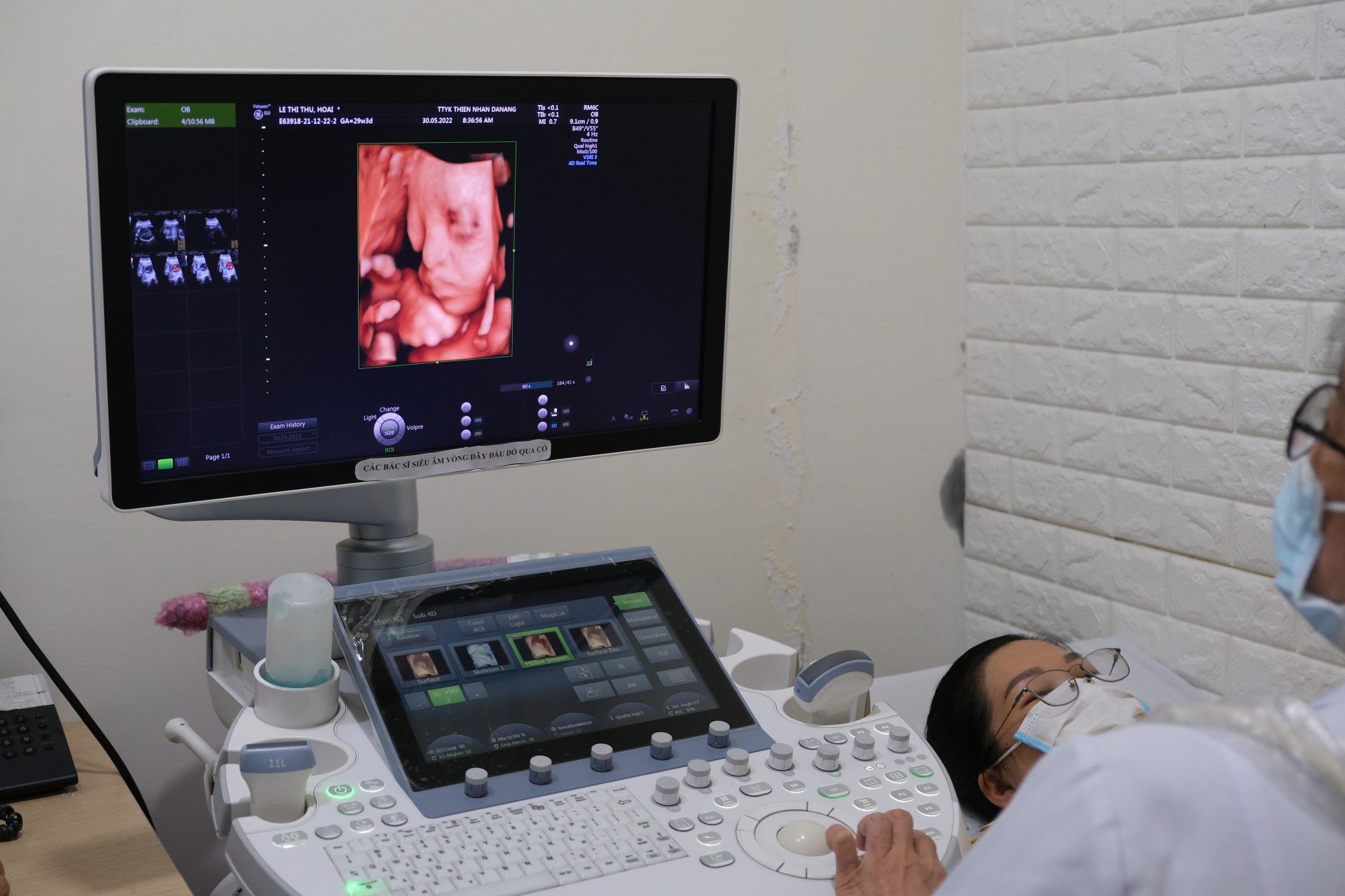 hình ảnh từ máy siêu âm thiện nhân hospital