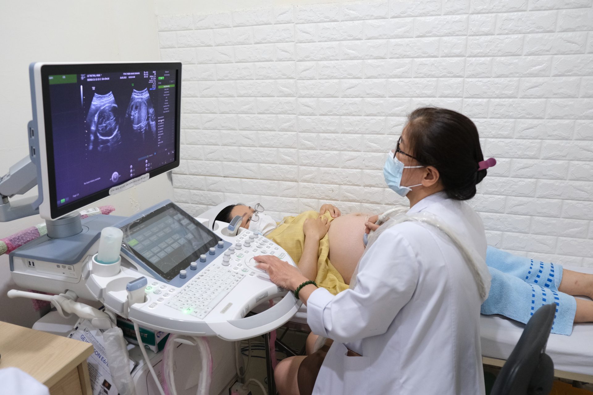 siêu âm sản phụ khoa