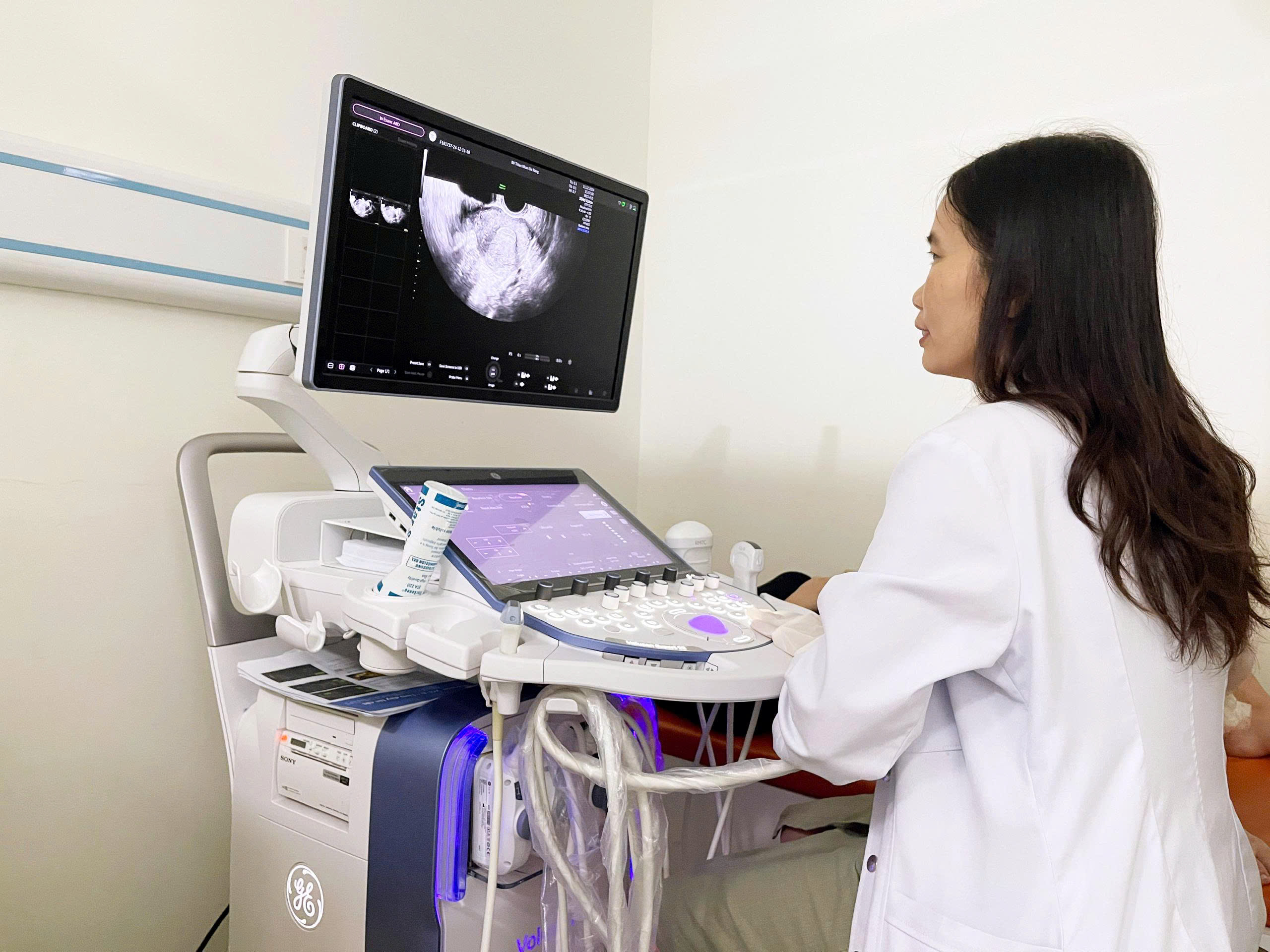 sieu am san voluson e22