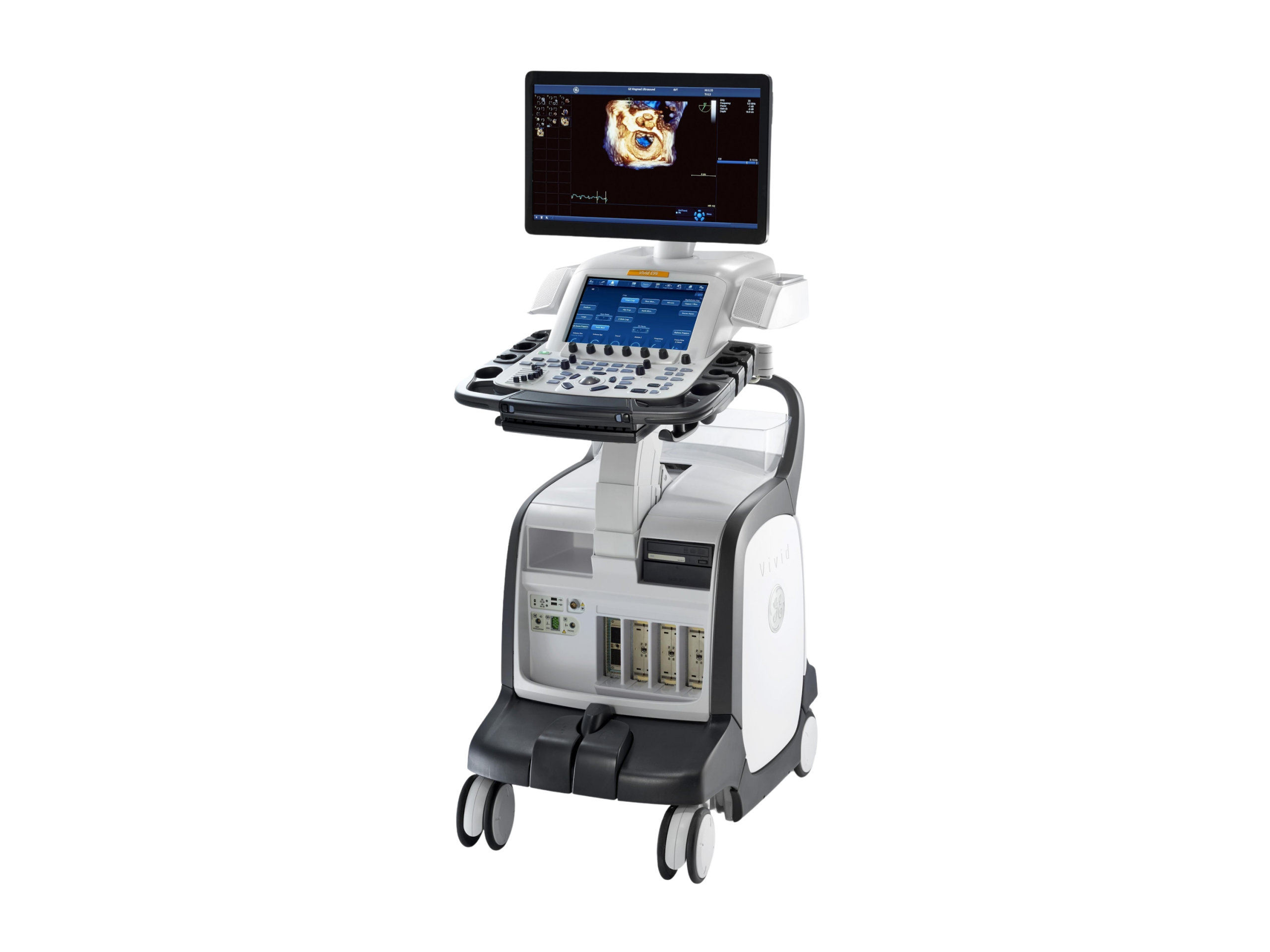 Máy siêu âm tim Vivid E95